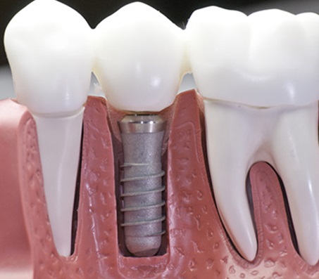 Nelank Dental Dentist